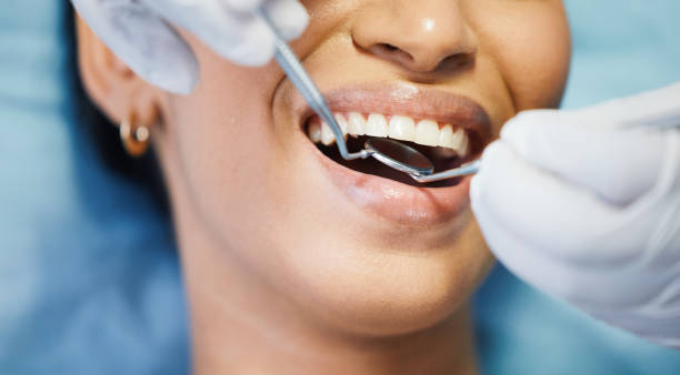Best Chipped Tooth Repair Near Me  in Lockport Heights, LA